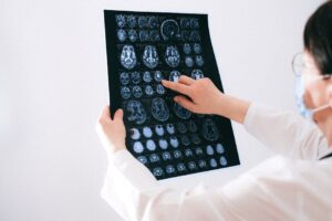 Understanding Olympus Scans For Precise Medical Imaging